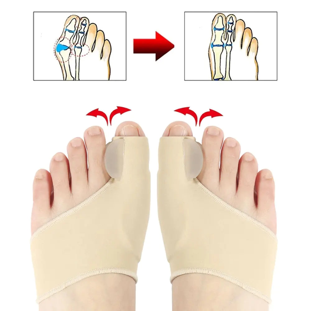 FlexToe Corrector